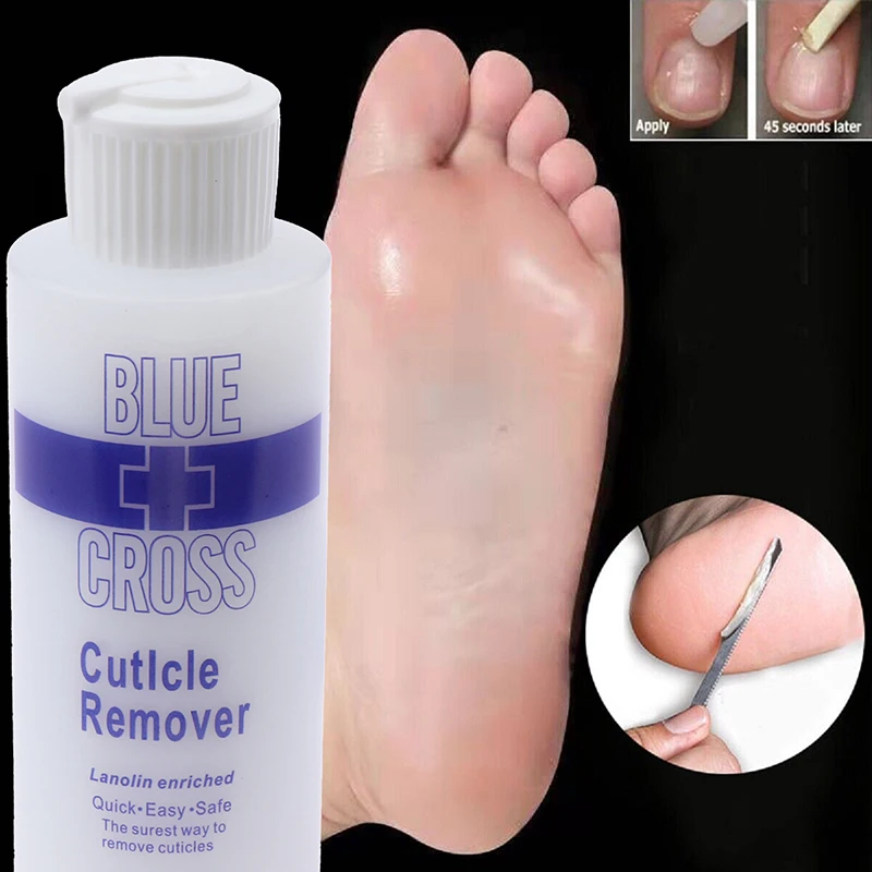 Foot Mask Peeling - 30/177 มล. น้ำยาขจัดหนังกำพร้าเท้า ผลิตภัณฑ์ขัดผิวเท้า น้ำยาขจัดเซลล์ผิวที่ตายแล้วและหนังด้าน มาส์กเท้า