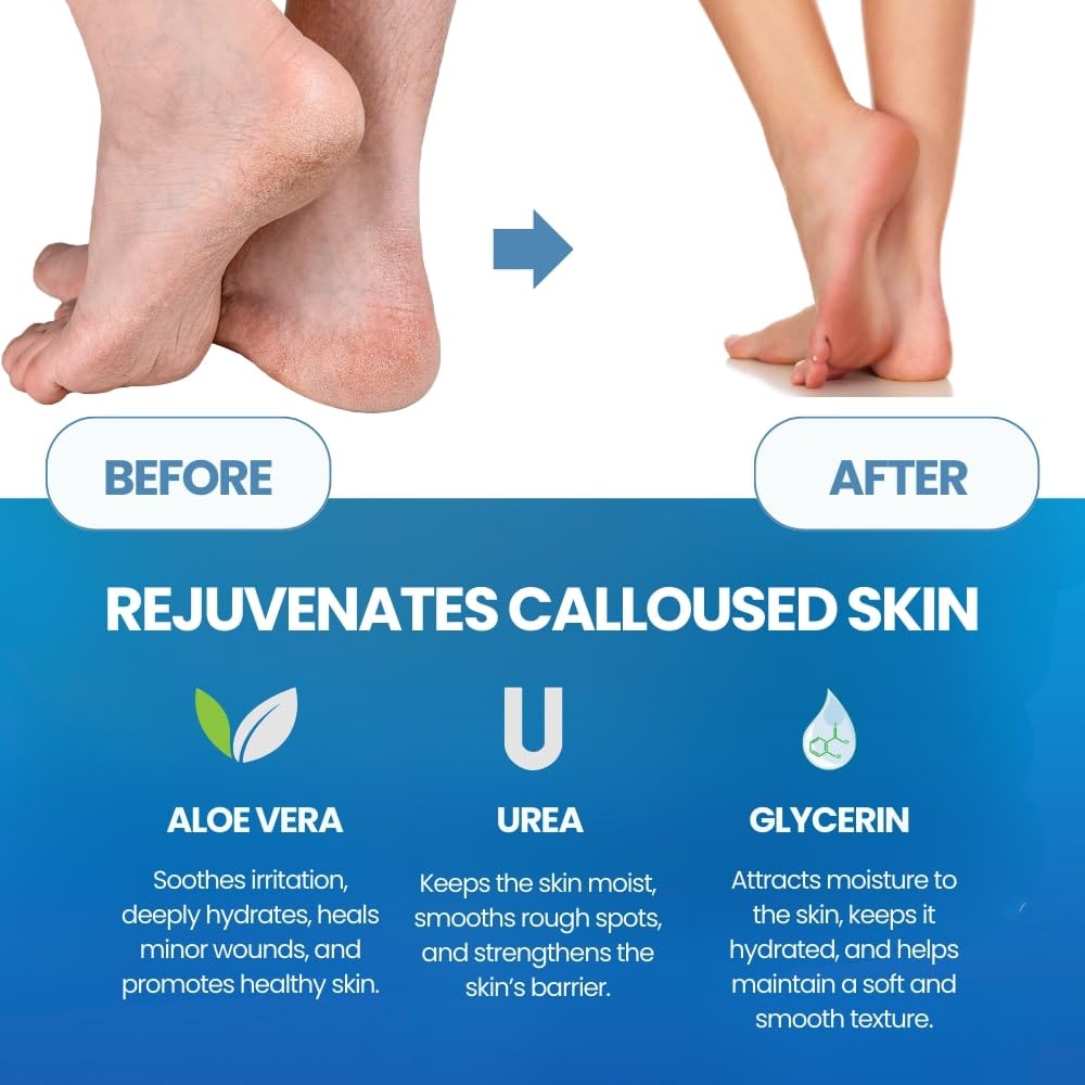 ผลิตภัณฑ์ขัดผิวเท้า กำจัดหนังก - Foot Mask Peeling บทวิจารณ์และราคา