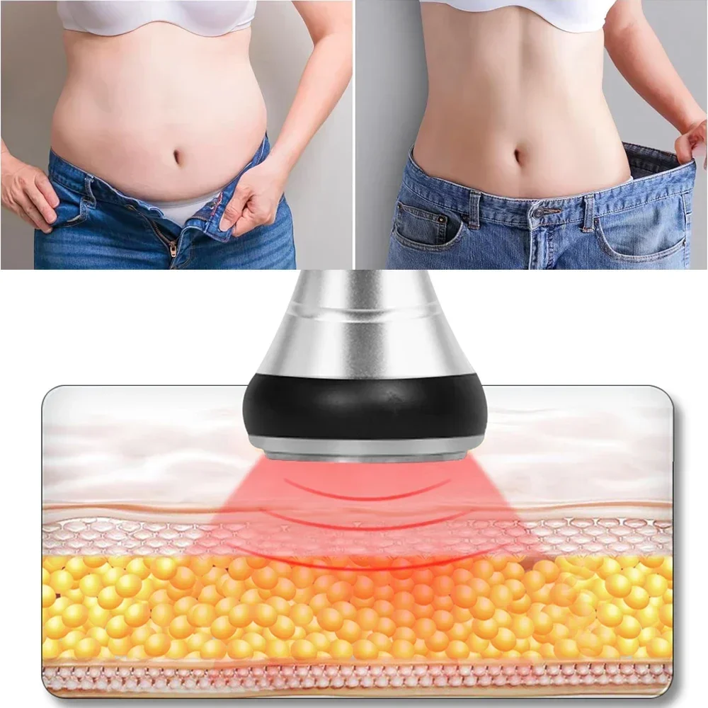 เครื่องนวดสลายไขมัน 4 in 1 40K - Spa Y Wellness บทวิจารณ์และราคา