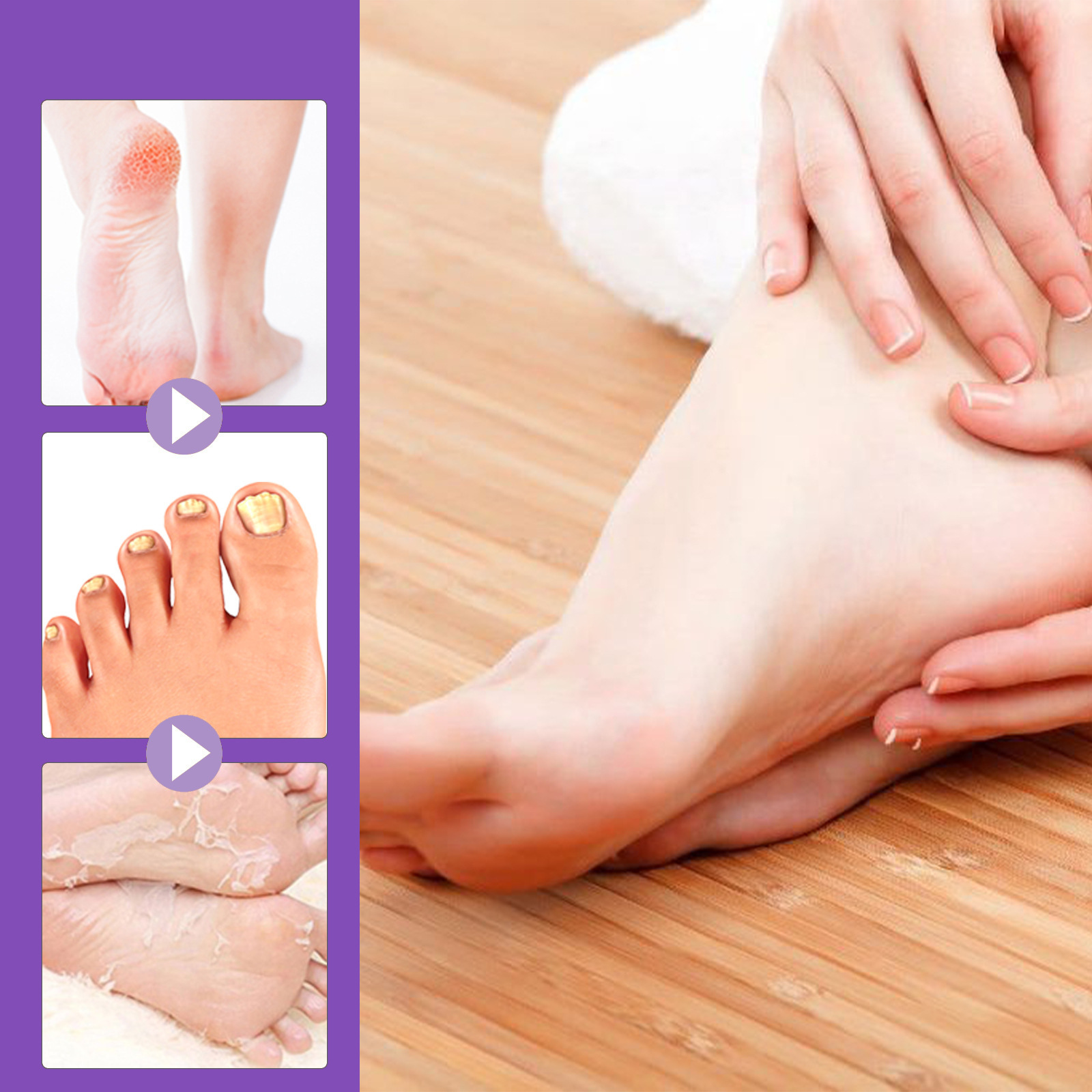 มาส์กเท้าขัดผิวลดผิวหนังที่ตาย - Foot Mask Peeling บทวิจารณ์และราคา