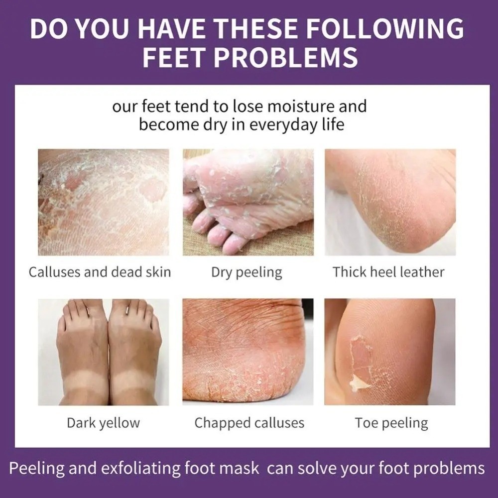 มาส์กเท้าลาเวนเดอร์บำรุงผิว ลด - Foot Mask Peeling บทวิจารณ์และราคา