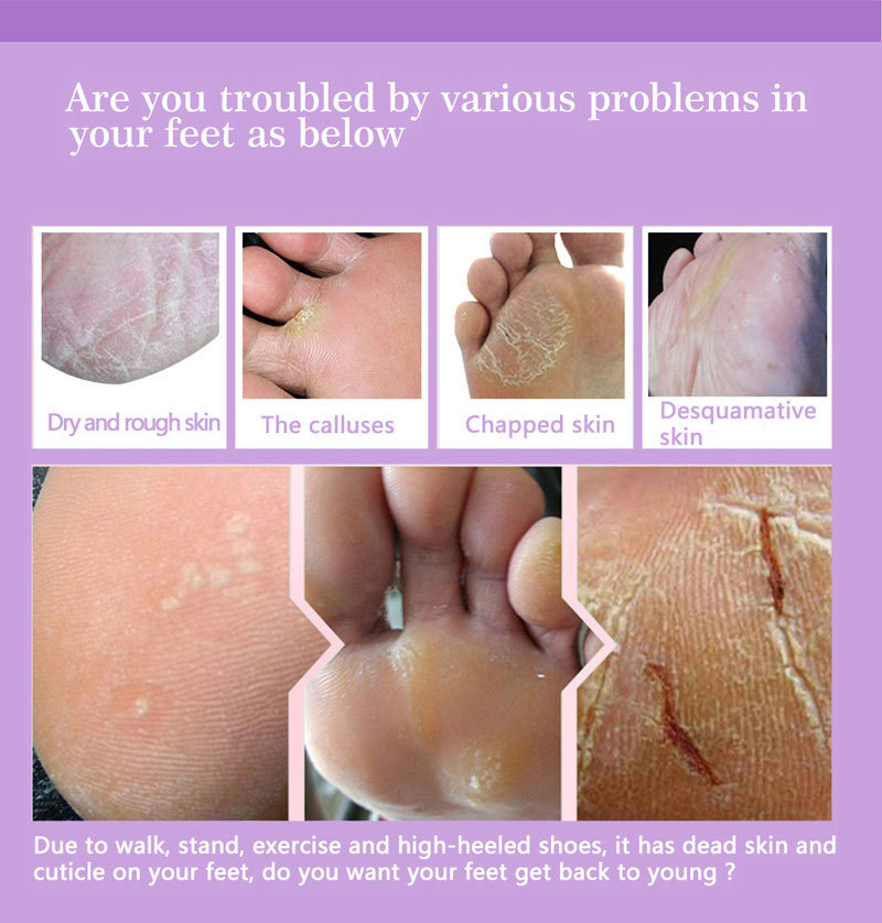 มาส์กขัดผิวเท้า ถุงเท้าขัดเท้า - Foot Mask Peeling บทวิจารณ์และราคา