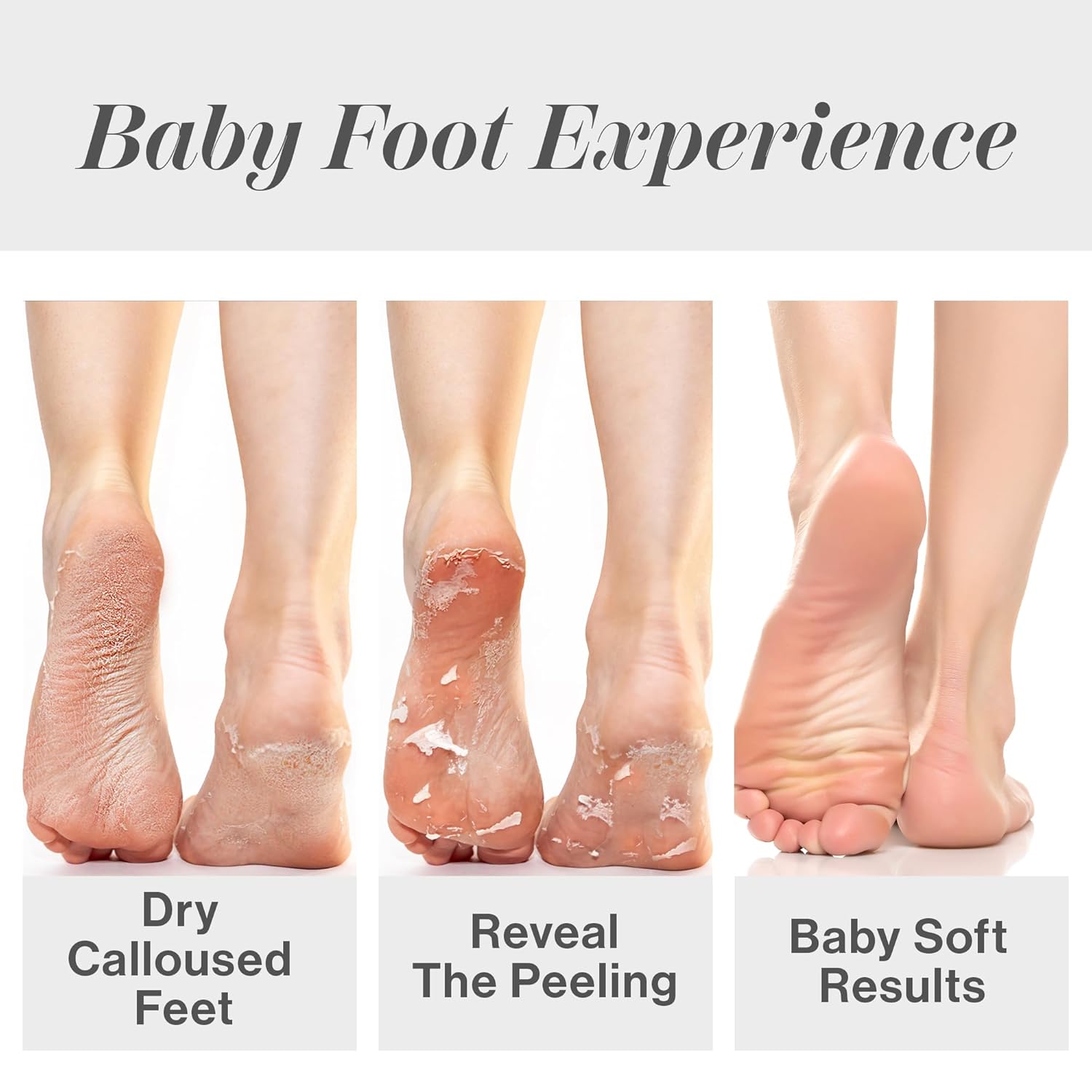 ถุงเท้าขัดผิว ขจัดหนังด้าน ขจั - Foot Mask Peeling บทวิจารณ์และราคา